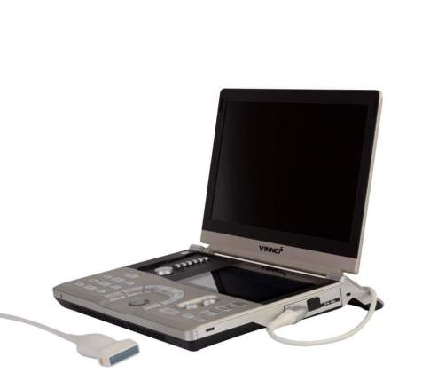 Ecografos Portatiles